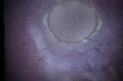 spermatozoi e ovulo