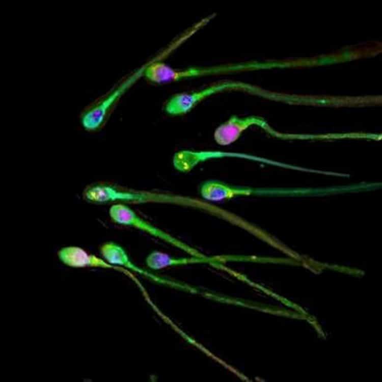 Microplastiche trovate nello sperma umano, studio italiano